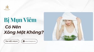 Xông mặt khi da đang mụn viêm – làm đẹp hay sai lầm tai hại?