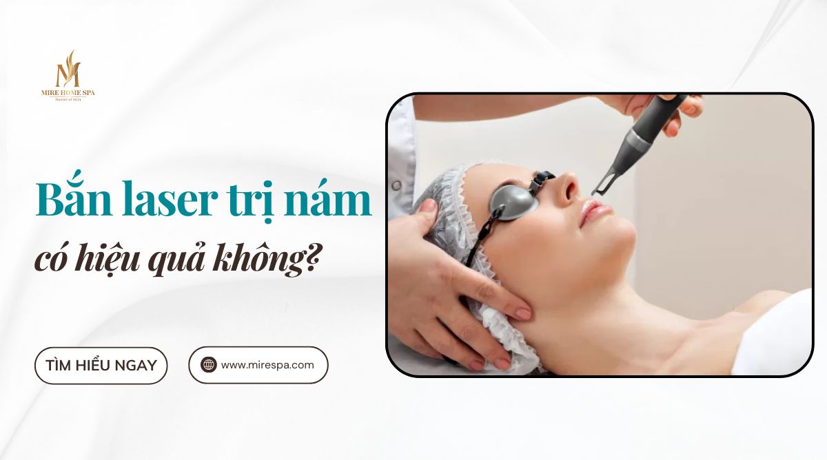 Bắn laser trị nám có hiệu quả không Nên lựa chọn khi nào
