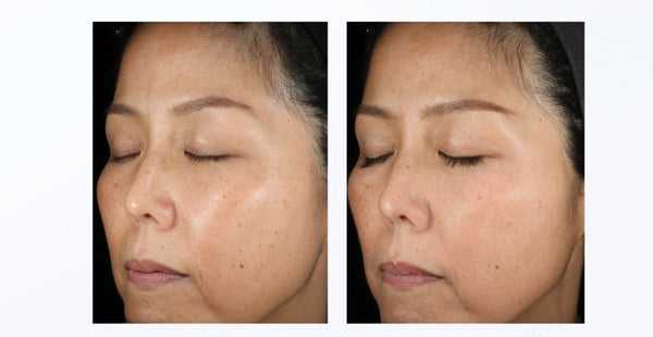 Arbutin có khả năng ức chế enzyme tyrosinase, qua đó ngăn cản sự chuyển hoá và tạo thành melanin