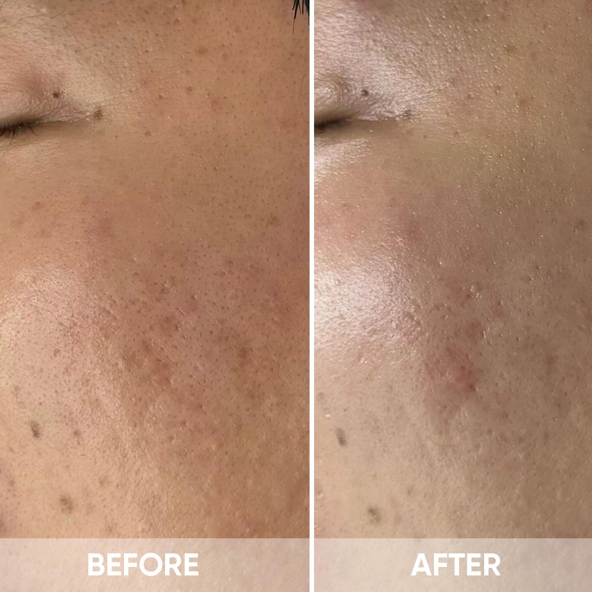  để trẻ hóa, làm sáng, đều màu da, giảm sẹo và tăng độ đàn hồ